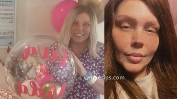 Simony posta foto após fim da quimioterapia