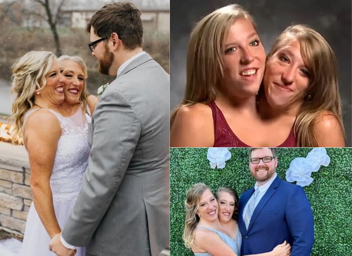 Casamento de gêmeas siamesas deu nova reviravolta